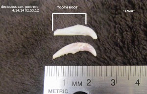 Extracted baby teeth - canine overbite challenges 