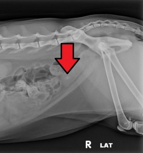 NaNa with the bladder stone