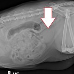 After bladder stones