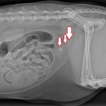 Xray with bladder stones