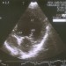 ultrasound